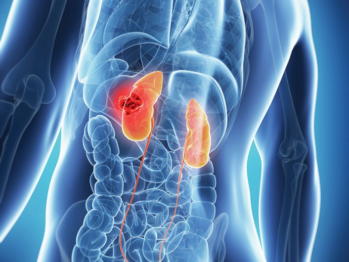 7 Quick Kidney Care Tips